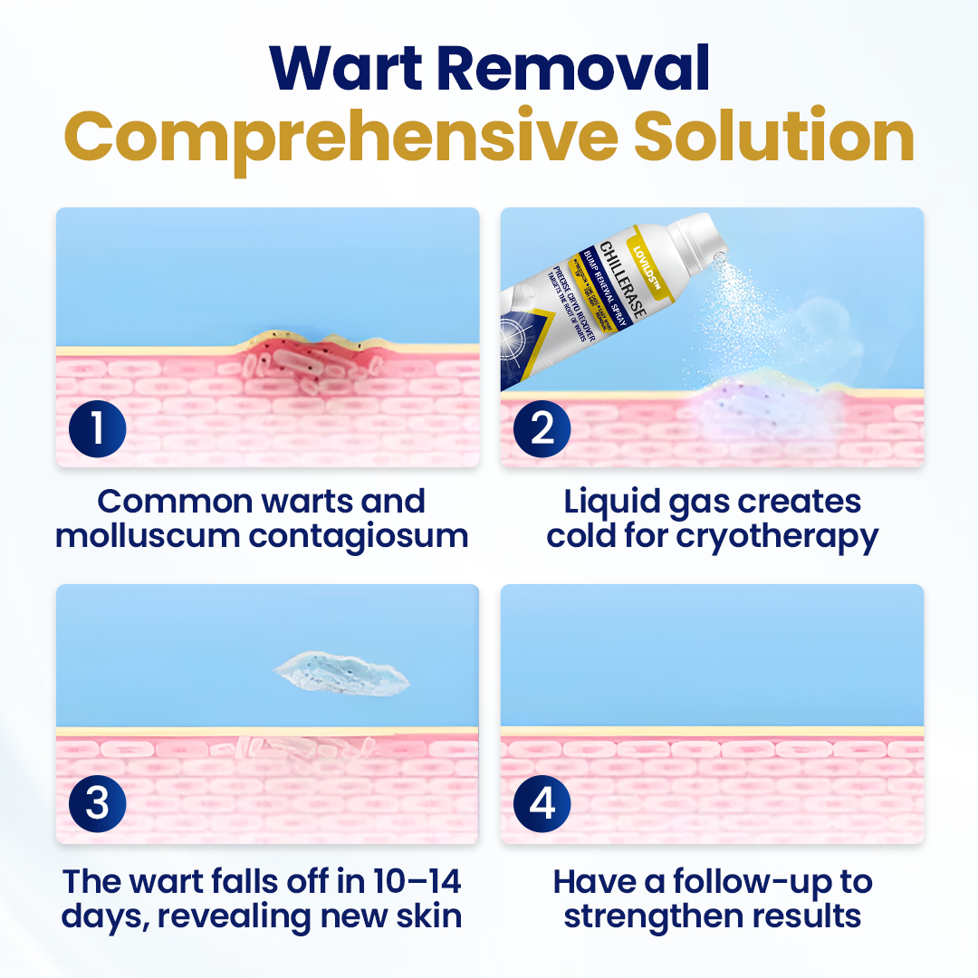 LOVILDS™ ChillErase Bump Renewal Spray