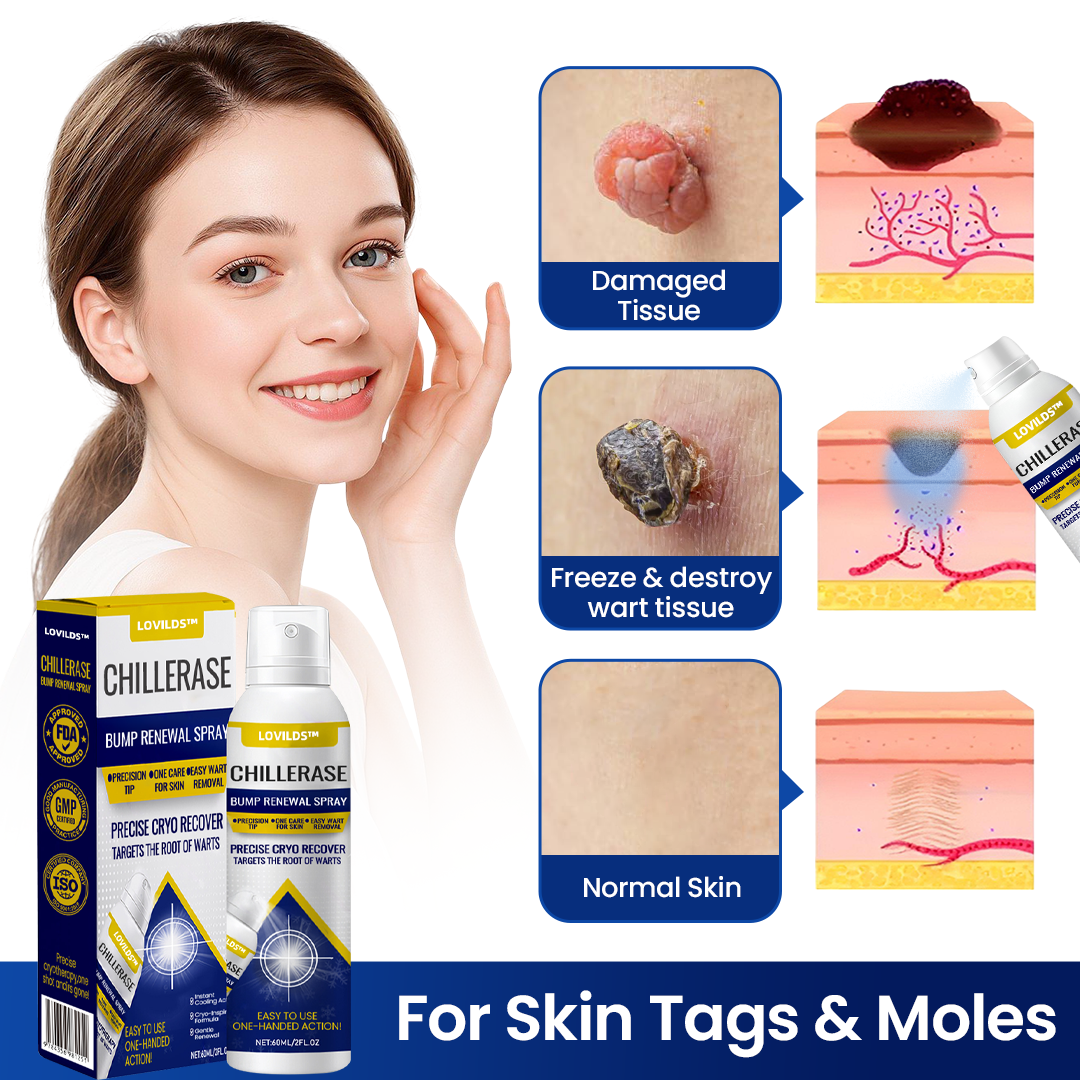 LOVILDS™  ChillErase Bump Renewal Spray