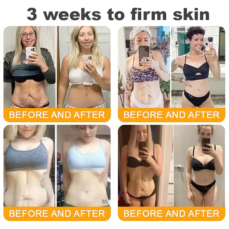 Bee Venom Skin Restoration Moisturizing Cream