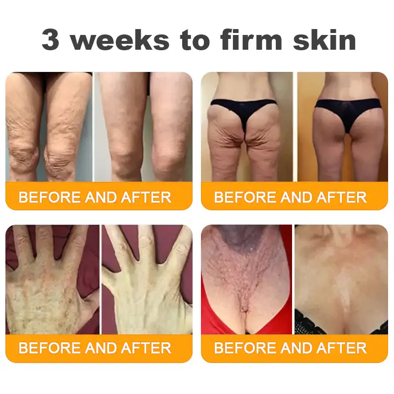 Bee Venom Skin Restoration Moisturizing Cream