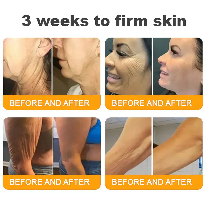 Bee Venom Skin Restoration Moisturizing Cream