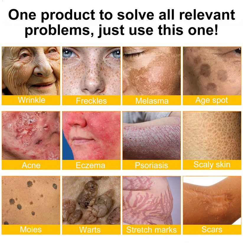 Bee Venom Skin Restoration Moisturizing Cream