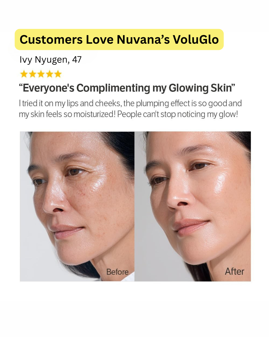 Advanced Korean Skin Volufiline Serum
