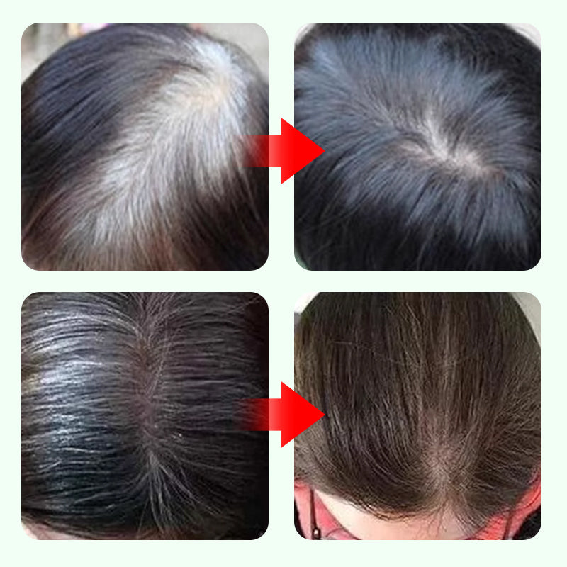 💇‍♀️Buy 1 Get 1 Free✨ 10-Second Root Rescue! Gray Coverage Hair Pen - Instant Youth in a Click! ✨
